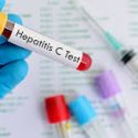  Realizan detecciones gratuitas  de Hepatitis “C” en Tamaulipas