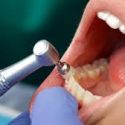  Dentistas y oftalmólogos los más  denunciados en arbitraje médico