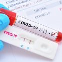  Aplican pruebas rápidas para detectar COVID-19 en distrito 05