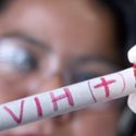  Siguen a la alza los casos de VIH en población joven en el sur de Tamaulipas.