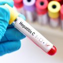  Buscará SST casos de Hepatitis C en centros de rehabilitación de adicciones
