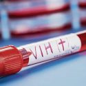 Baja incidencia de casos de VIH en la región Mante, sólo confirman cinco casos nuevos en el 2023.