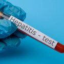  Aumentan casos de Hepatitis C