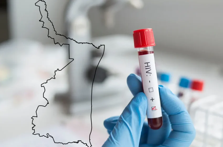  Estiman sub registro de casos de VIH en Tamaulipas